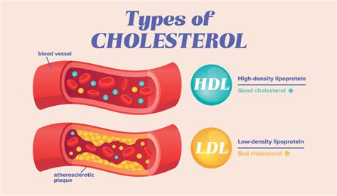 hdl 콜레스테롤 높으면, 우주 여행도 가능할까?